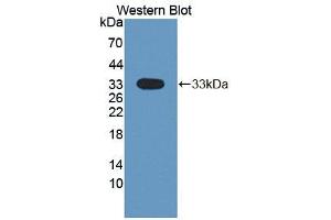 Western blot analysis of the recombinant protein. (DSTYK antibody  (AA 650-904))