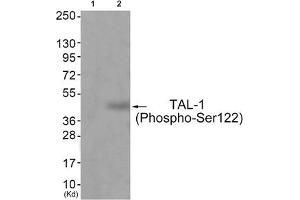 Western blot analysis of extracts from JK cells (Lane 2), using TAL-1 (Phospho-Ser122) Antibody. (TAL1 antibody  (pSer122))