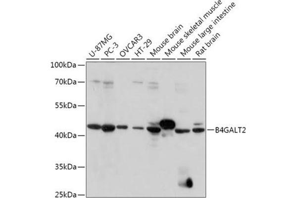 B4GALT2 anticorps  (AA 155-271)
