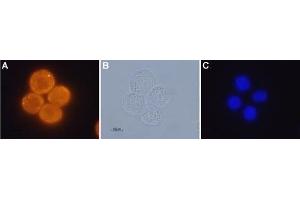 Expression of OX1R in human colon cancer cell lines - Immunocytochemical staining of paraformaldehyde fixed and permeabilized human Colo-205 colon cancer cells A. (HCRTR1 antibody  (AA 256-269))