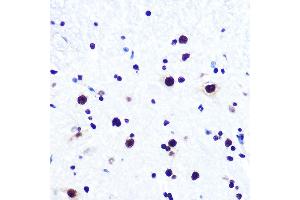 Immunohistochemistry of paraffin-embedded mouse spinal cord using DDX5 Rabbit mAb (ABIN7266698) at dilution of 1:100 (40x lens).