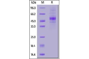 Human CD19 (20-291) Protein, His Tag on  under reducing (R) condition.