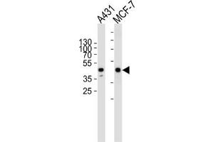 Western Blotting (WB) image for anti-Calcitonin Receptor (CALCR) antibody (ABIN3002412) (Calcitonin Receptor antibody)