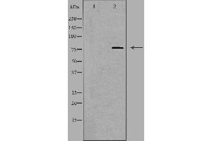Western blot analysis of extracts from HUVEC, using SKIL antibody. (SKIL antibody  (C-Term))