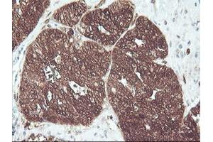 Image no. 7 for anti-CNDP Dipeptidase 2 (Metallopeptidase M20 Family) (CNDP2) antibody (ABIN1497548) (CNDP2 antibody)