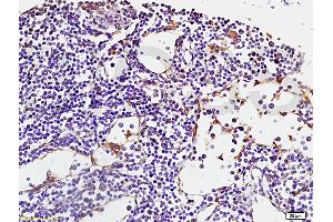 Formalin-fixed and paraffin embedded human spleen tissue labeled with Anti-RANK/CD265 Polyclonal Antibody, Unconjugated (ABIN749258) at 1:200 followed by conjugation to the secondary antibody, (SP-0023), and DAB staining (TNFRSF11A antibody  (AA 51-150))