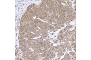 Immunohistochemistry (IHC) image for anti-Ribosomal Protein L5 (RPL5) (AA 247-297) antibody (ABIN7454984) (RPL5 antibody  (AA 247-297))