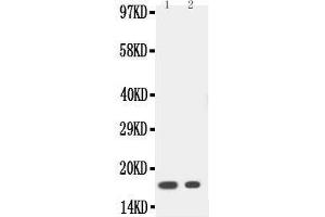 Anti-IL1 beta antibody, Western blotting Lane 1: Recombinant Human IL-1 beta Protein 20ng Lane 2: Recombinant Human IL-1 beta Protein 10ng