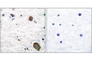 Immunohistochemistry analysis of paraffin-embedded human brain tissue, using GFR alpha-1 Antibody. (GFRA1 antibody  (AA 51-100))