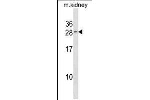 Western blot analysis in kidney cell line lysates (35ug/lane). (VPS25 antibody  (C-Term))