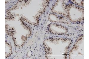 Immunoperoxidase of monoclonal antibody to RBM6 on formalin-fixed paraffin-embedded human prostate.