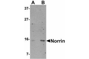 Image no. 1 for anti-Norrie Disease (Pseudoglioma) (NDP) (N-Term) antibody (ABIN478068) (Norrie Disease (Pseudoglioma) antibody  (N-Term))
