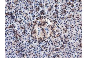 Image no. 1 for anti-F-Box Protein 21 (FBXO21) antibody (ABIN1498231) (FBXO21 antibody)
