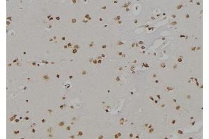 ABIN6277140 at 1/100 staining Human brain tissue by IHC-P. (ALOX5 antibody  (C-Term))