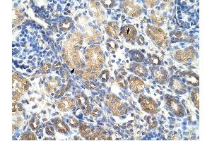 GNB1L antibody was used for immunohistochemistry at a concentration of 4-8 ug/ml to stain Epithelial cells of renal tubule (arrows) in Human Kidney. (GNB1L antibody)