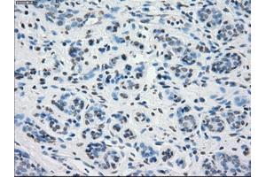 Immunohistochemical staining of paraffin-embedded breast tissue using anti-PPP5C mouse monoclonal antibody. (PP5 antibody)
