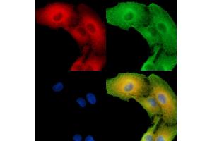 ABIN7096261 and ABIN7100323 staining  cells by IF/ICC. (SLC25A43 antibody)