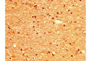 IHC image of ABIN7168378 diluted at 1:500 and staining in paraffin-embedded human brain tissue performed on a Leica BondTM system. (MSI1 antibody  (AA 221-347))