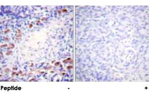 Immunohistochemical analysis of paraffin-embedded human ovary tissue using DAXX polyclonal antibody . (DAXX antibody)