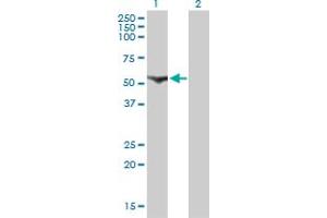 Western Blotting (WB) image for anti-Cytidine and DCMP Deaminase Domain Containing 1 (CDADC1) (AA 423-515) antibody (ABIN466247) (CDADC1 antibody  (AA 423-515))