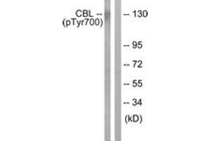 Western blot analysis of extracts from K562 cells treated with Na3VO4 0. (CBL antibody  (pTyr700))