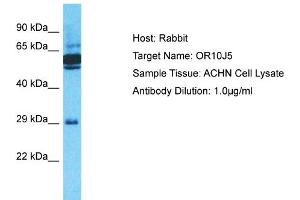 Host: Rabbit Target Name: OR10J5 Sample Type: ACHN Whole Cell lysates Antibody Dilution: 1.