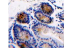 Used in DAB staining on fromalin fixed paraffin-embedded Intestine tissue (AGGF1 antibody  (AA 406-501))