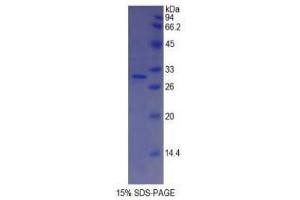 SDS-PAGE (SDS) image for Complement Factor I (CFI) (AA 340-583) protein (His tag) (ABIN2120881)