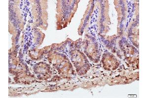 Paraformaldehyde-fixed, paraffin embedded mouse intestine tissue, Antigen retrieval by boiling in sodium citrate buffer(pH6) for 15min, Block endogenous peroxidase by 3% hydrogen peroxide for 30 minutes, Blocking buffer (normal goat serum) at 37°C for 20min, Antibody incubation with ZnT-1 Polyclonal Antibody, Unconjugated  at 1:500 overnight at 4°C, followed by a conjugated secondary and DAB staining