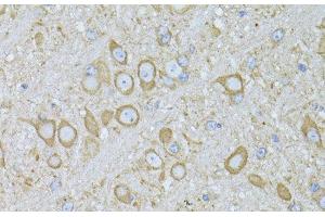 Immunohistochemistry of paraffin-embedded Mouse brain using MTNR1A Polyclonal Antibody at dilution of 1:100 (40x lens). (Melatonin Receptor 1A antibody)