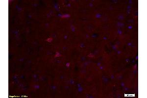 Formalin-fixed and paraffin embedded rat brain labeled with Anti-S100B Polyclonal Antibody, Unconjugated (ABIN676703) at 1:200 followed by conjugation to the secondary antibody and DAB staining. (S100B antibody  (AA 31-92))