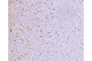 IHC analysis of CLASP1 using anti-CLASP1 antibody (ABIN7599144). (CLASP1 antibody  (AA 1-243))