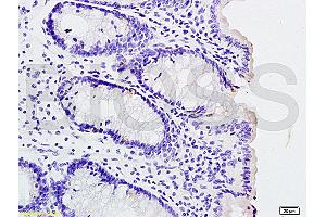 Formalin-fixed and paraffin embedded rat colitis labeled with Rabbit Anti phospho-IL-1R1(Tyr496) Polyclonal Antibody, Unconjugated (ABIN801423) at 1:200 followed by conjugation to the secondary antibody and DAB staining