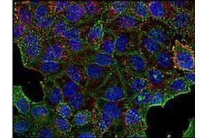 Immunofluorescence (IF) image for anti-Clathrin Heavy Chain (CLTC) (Heavy Chain) antibody (ABIN238388) (Clathrin Heavy Chain (CLTC) (Heavy Chain) antibody)