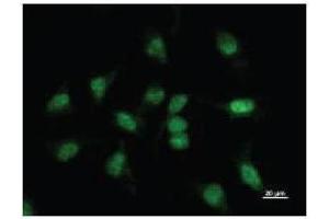 Immunostaining analysis in HeLa cells. (BBX antibody)
