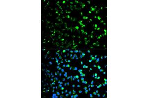 Immunofluorescence analysis of HeLa cell using TYMP antibody. (Thymidine Phosphorylase antibody)