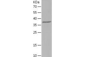 Western Blotting (WB) image for Hyaluronidase-2 (HYAL2) (AA 295-448) protein (His-IF2DI Tag) (ABIN7123374) (HYAL2 Protein (AA 295-448) (His-IF2DI Tag))