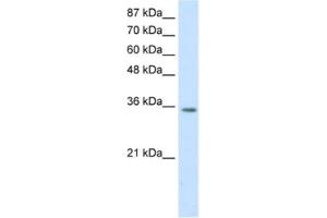 Western Blotting (WB) image for anti-Homeobox D4 (HOXD4) antibody (ABIN2461853) (HOXD4 antibody)