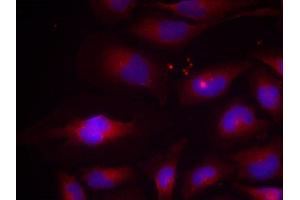 Immunofluorescence (IF) image for anti-Nuclear Factor of kappa Light Polypeptide Gene Enhancer in B-Cells 2 (NFKB2) (pSer870) antibody (ABIN1870475) (NFKB2 antibody  (pSer870))