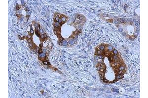 Image no. 1 for anti-Trefoil Factor 1 (TFF1) (AA 1-84) antibody (ABIN1501358) (TFF1 antibody  (AA 1-84))
