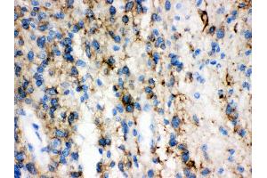 Anti-GAP43 antibody, IHC(P) IHC(P): Human Glioma Tissue (GAP43 antibody  (C-Term))