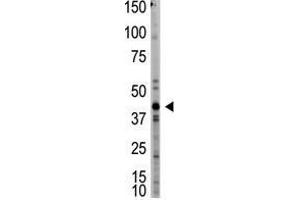 Image no. 1 for anti-Myostatin (MSTN) (N-Term) antibody (ABIN357462) (MSTN antibody  (N-Term))