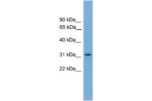 WB Suggested Anti-PIGL  Antibody Titration: 0.