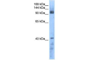RecQL5 antibody used at 0.