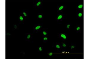 Immunofluorescence of monoclonal antibody to ISL1 on HeLa cell.