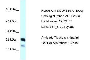 Western Blotting (WB) image for anti-NADH Dehydrogenase (Ubiquinone) 1 beta Subcomplex, 10, 22kDa (NDUFB10) (C-Term) antibody (ABIN2789283) (NDUFB10 antibody  (C-Term))