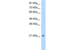 Western Blotting (WB) image for anti-Fer3-Like (FERD3L) antibody (ABIN2461316) (FERD3L antibody)