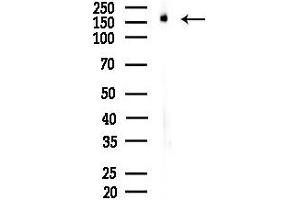 Western blot analysis of lysates from Rat testis, using Bcr Antibody at 1/1000 dilution.
