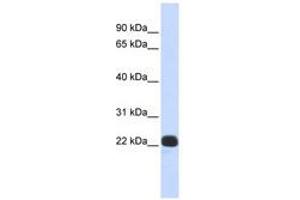 Image no. 1 for anti-Recoverin (RCVRN) (N-Term) antibody (ABIN6740369) (Recoverin antibody  (N-Term))