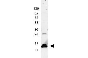 anti-Human IL-9 antibody shows detection of a band ~15 kDa in size corresponding to recombinant human IL-9. (IL-9 antibody)